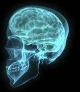 xray-brain